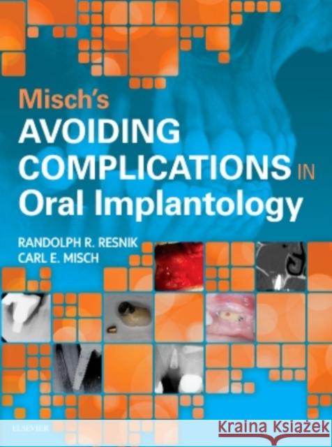 Misch's Avoiding Complications in Oral Implantology Carl E. Misch Randolph Resnik 9780323375801 Mosby - książka