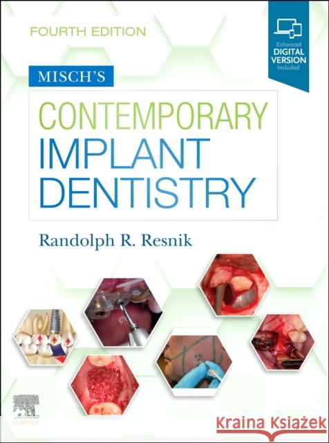 Misch's Contemporary Implant Dentistry Randolph Resnik 9780323391559 Mosby - książka
