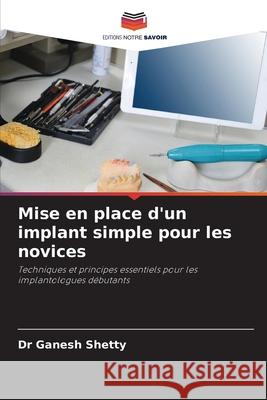 Mise en place d'un implant simple pour les novices Shetty, Dr Ganesh 9786200712820 Editions Notre Savoir - książka