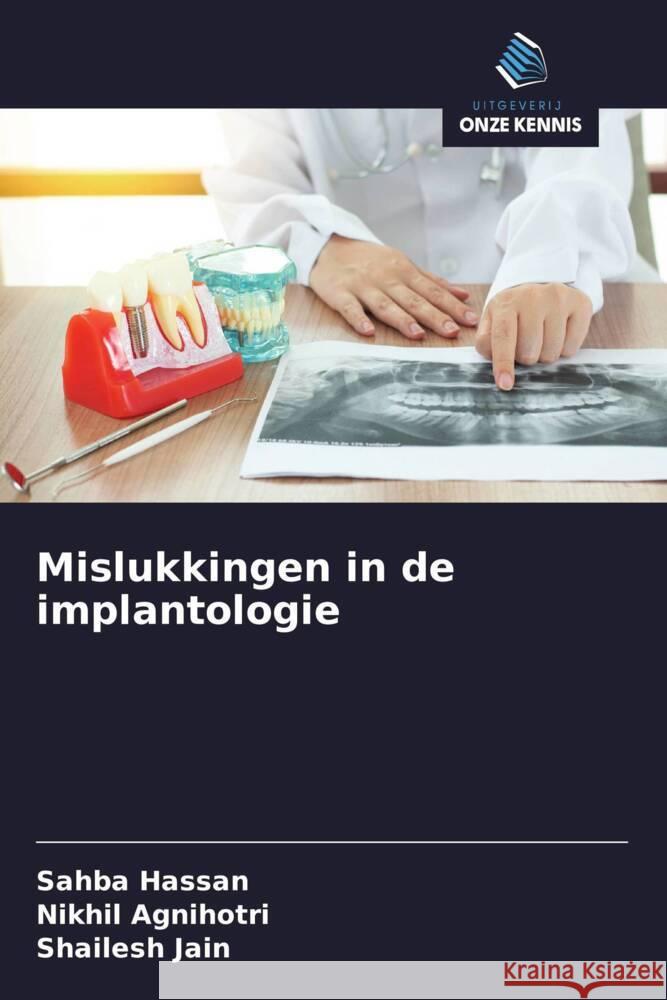 Mislukkingen in de implantologie Hassan, Sahba, Agnihotri, Nikhil, Jain, Shailesh 9786208286026 Uitgeverij Onze Kennis - książka