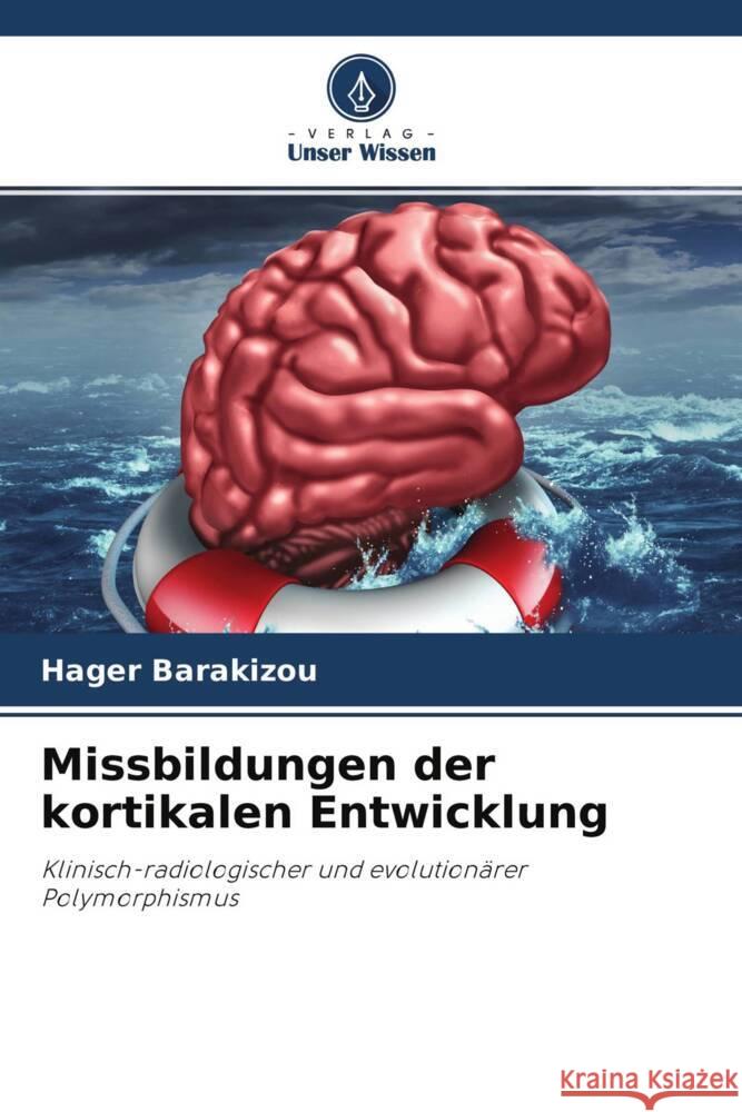 Missbildungen der kortikalen Entwicklung Barakizou, Hager 9786204665962 Verlag Unser Wissen - książka