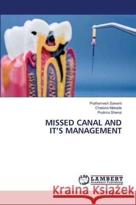Missed Canal and It's Management Prathamesh Sawant Chetana Makade Pratima Shenoi 9786630304930 LAP Lambert Academic Publishing - książka