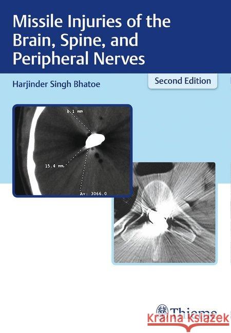 Missile Injuries of the Brain, Spine, and Peripheral Nerves Bhatoe, Harjinder Singh 9789388257107 Thieme Publishers Delhi - książka