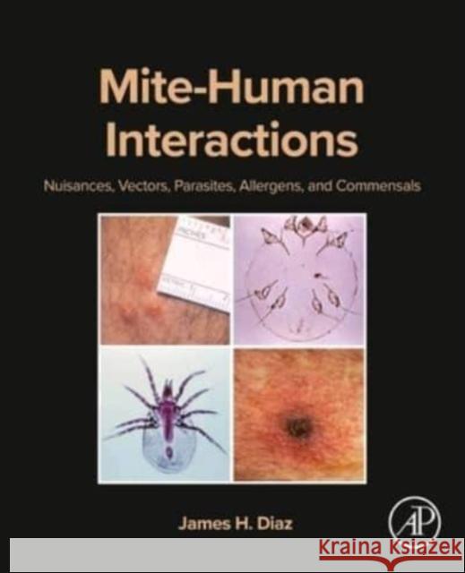 Mite-Human Interactions James H. (Professor of Public Health and Preventive Medicine, LSU School of Public Health; Professor of Anesthesiology a 9780443235245 Elsevier Science Publishing Co Inc - książka