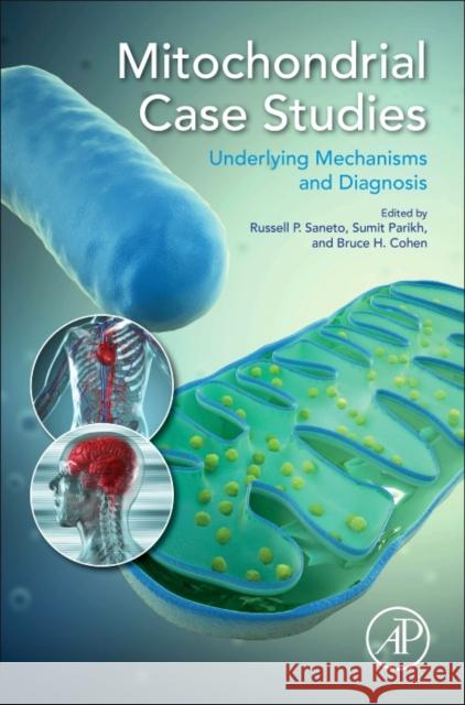 Mitochondrial Case Studies: Underlying Mechanisms and Diagnosis Saneto, Russell Parikh, Sumit Cohen, Bruce H 9780128008775 Elsevier Science - książka