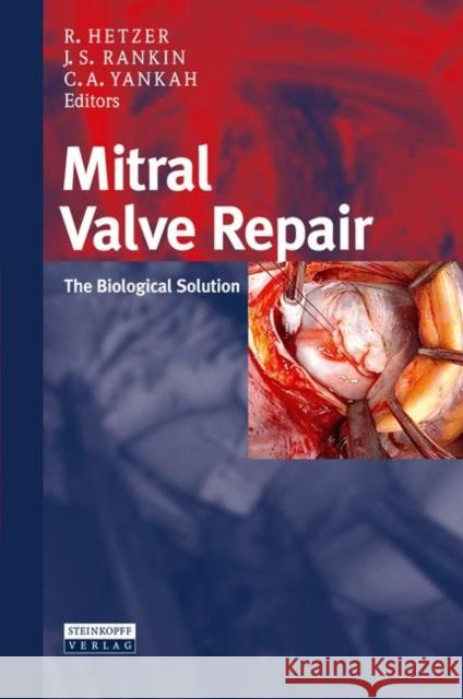 Mitral Valve Repair: The Biological Solution Hetzer, Roland 9783798518667 Springer - książka