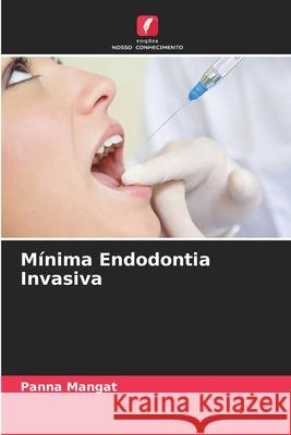 Mínima Endodontia Invasiva Panna Mangat 9786204115665 Edicoes Nosso Conhecimento - książka