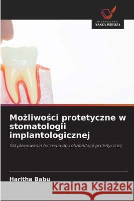 Możliwości protetyczne w stomatologii implantologicznej Haritha Babu 9786630221282 Wydawnictwo Nasza Wiedza - książka