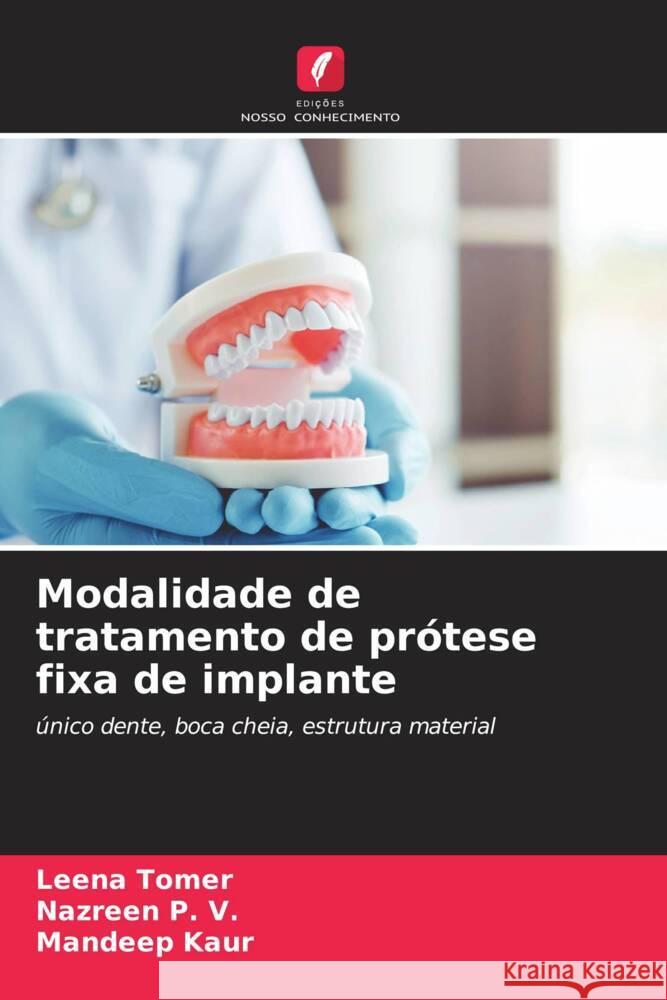 Modalidade de tratamento de prótese fixa de implante Tomer, Leena, P. V., Nazreen, Kaur, Mandeep 9786205135075 Edições Nosso Conhecimento - książka