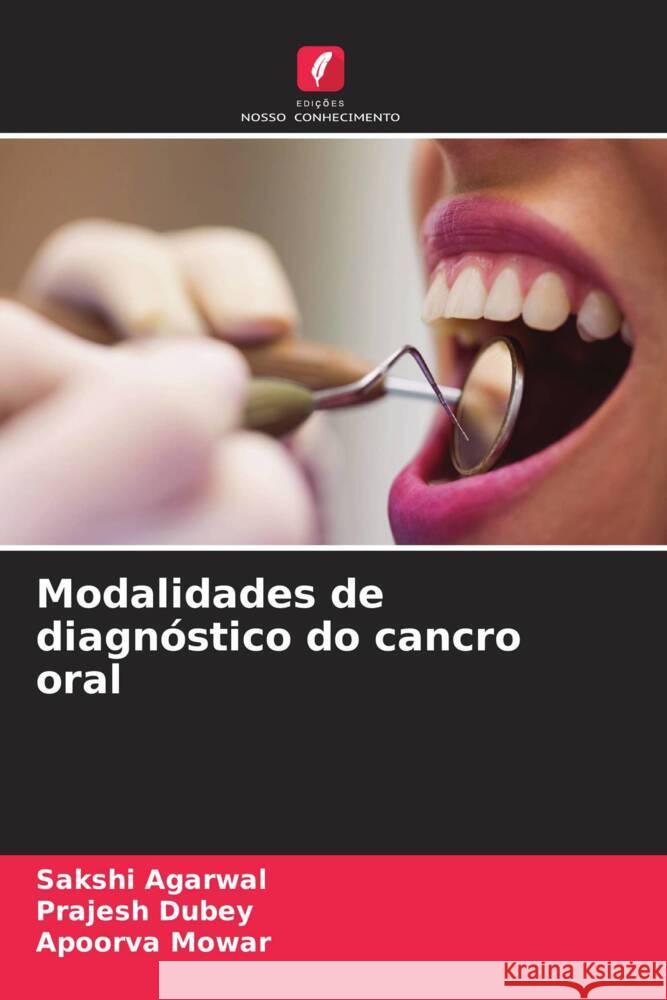 Modalidades de diagnóstico do cancro oral Agarwal, Sakshi, Dubey, Prajesh, Mowar, Apoorva 9786204895253 Edições Nosso Conhecimento - książka
