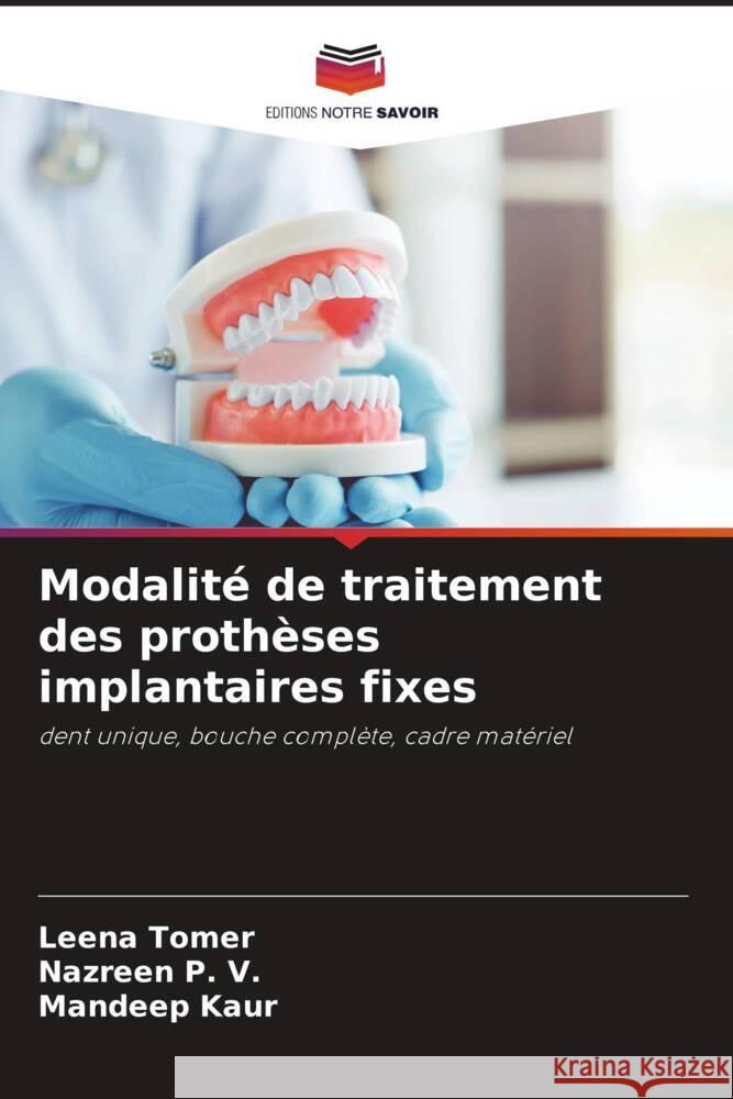 Modalité de traitement des prothèses implantaires fixes Tomer, Leena, P. V., Nazreen, Kaur, Mandeep 9786205135051 Editions Notre Savoir - książka