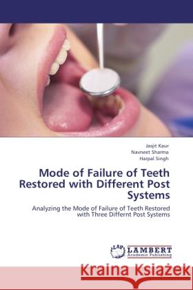 Mode of Failure of Teeth Restored with Different Post Systems : Analyzing the Mode of Failure of Teeth Restored with Three Differnt Post Systems Kaur, Jasjit; Sharma, Navneet; Singh, Harpal 9783846523230 LAP Lambert Academic Publishing - książka