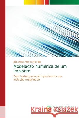 Modelação numérica de um implante Filipe, João Diogo Pires Costa 9786202189002 Novas Edicioes Academicas - książka