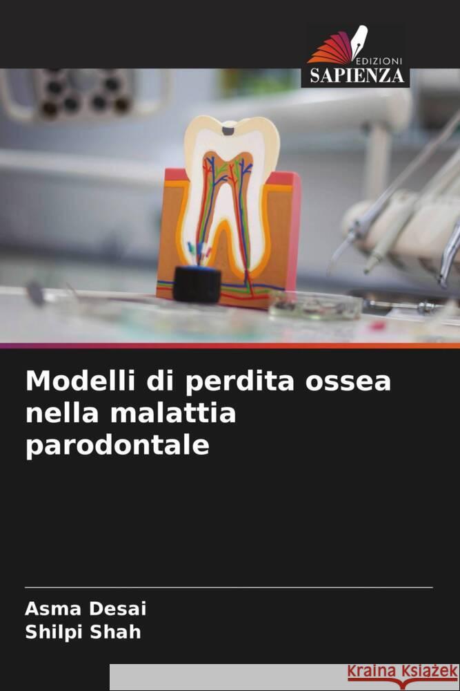 Modelli di perdita ossea nella malattia parodontale Asma Desai Shilpi Shah 9786206999720 Edizioni Sapienza - książka