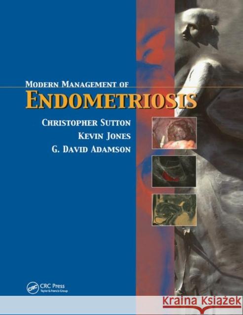 Modern Management of Endometriosis Christopher Sutton G. David Adamson Kevin D. Jones 9780367391669 CRC Press - książka