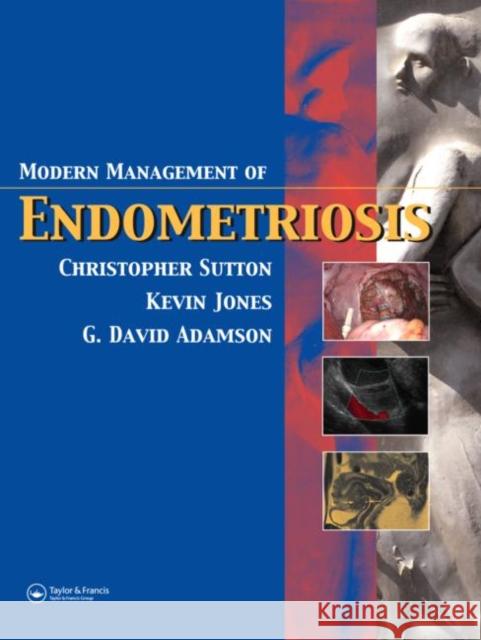 Modern Management of Endometriosis Christopher Sutton G. David Adamson Kevin Jones 9781842142769 Taylor & Francis Group - książka