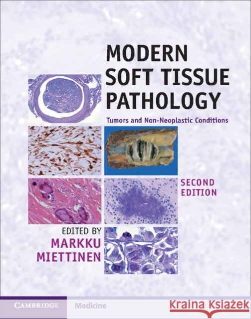 Modern Soft Tissue Pathology: Tumors and Non-Neoplastic Conditions Markku Miettinen 9781107567276 Cambridge University Press - książka