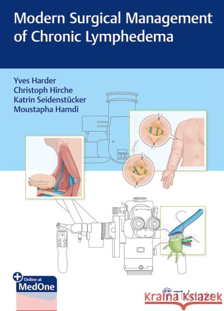 Modern Surgical Management of Chronic Lymphedema  9783132414280 Thieme Publishing Group - książka