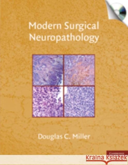 modern surgical neuropathology  Miller, Douglas C. 9780521869324  - książka