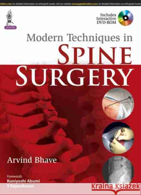 Modern Techniques in Spine Surgery Arvind Bhave 9789351525301 Jaypee Brothers Medical Publishers - książka