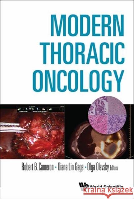 Modern Thoracic Oncology (in 3 Volumes) Robert Brian Cameron Olga Olevsky Diana Gage 9789814725514 World Scientific Publishing Company - książka