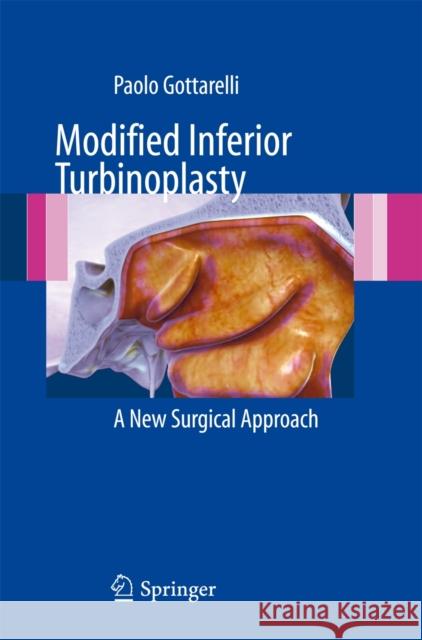 Modified Inferior Turbinoplasty: A New Surgical Approach Gottarelli, Paolo 9788847024410 Springer Verlag - książka