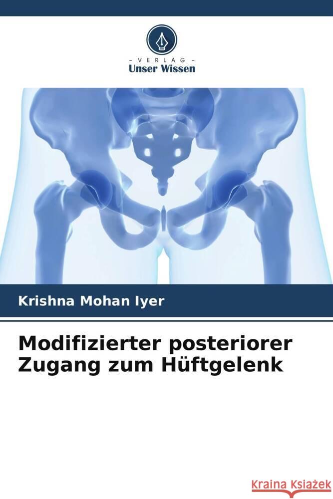 Modifizierter posteriorer Zugang zum H?ftgelenk Krishna Mohan Iyer 9786207499359 Verlag Unser Wissen - książka