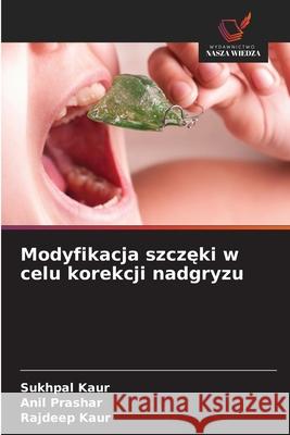 Modyfikacja szczeki w celu korekcji nadgryzu Kaur, Sukhpal, Prashar, Anil, Kaur, Rajdeep 9786208899226 Wydawnictwo Nasza Wiedza - książka