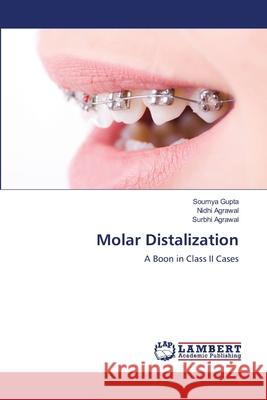 Molar Distalization Soumya Gupta Nidhi Agrawal Surbhi Agrawal 9786203195118 LAP Lambert Academic Publishing - książka