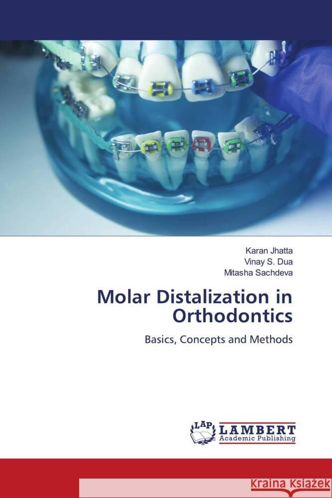 Molar Distalization in Orthodontics Jhatta, Karan, Dua, Vinay S., Sachdeva, Mitasha 9786200078339 LAP Lambert Academic Publishing - książka