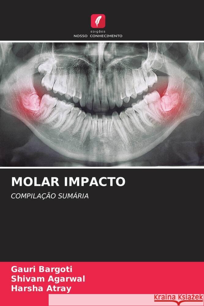 MOLAR IMPACTO Bargoti, Gauri, Agarwal, Shivam, Atray, Harsha 9786204857732 Edições Nosso Conhecimento - książka