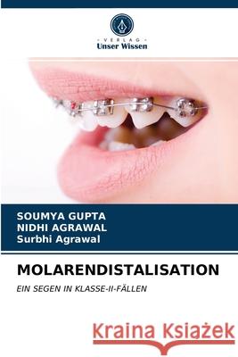 Molarendistalisation Soumya Gupta, Nidhi Agrawal, Surbhi Agrawal 9786203659740 Verlag Unser Wissen - książka