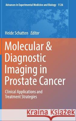 Molecular & Diagnostic Imaging in Prostate Cancer: Clinical Applications and Treatment Strategies Schatten, Heide 9783319992853 Springer - książka