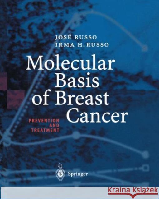 Molecular Basis of Breast Cancer: Prevention and Treatment Russo, Jose 9783642622700 Springer - książka