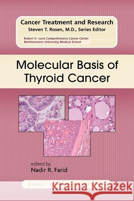 Molecular Basis of Thyroid Cancer Nadir R. Farid 9781441954763 Not Avail - książka