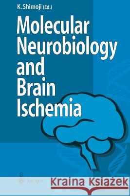 Molecular Biology and Brain Ischemia Koji Shimoji 9784431684695 Springer - książka