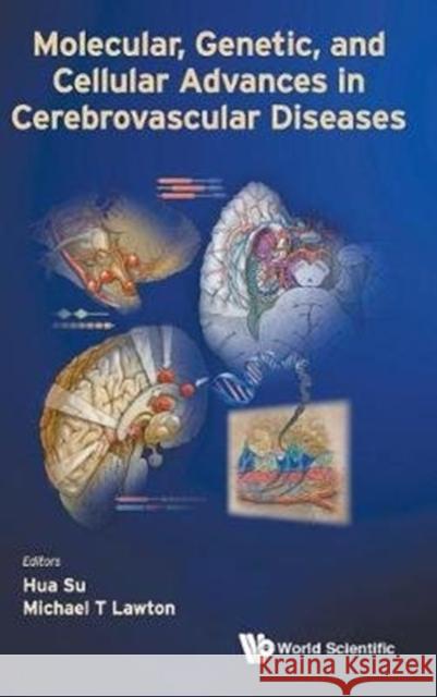 Molecular, Genetic, and Cellular Advances in Cerebrovascular Diseases Hua Su Michael T. Lawton 9789814723299 World Scientific Publishing Company - książka