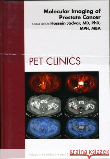 Molecular Imaging of Prostate Cancer, an Issue of Pet Clinics: Volume 4-2 Jadvar, Hossein 9781437708806 W.B. Saunders Company - książka