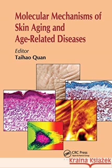 Molecular Mechanisms of Skin Aging and Age-Related Diseases  9780367783006 Taylor and Francis - książka