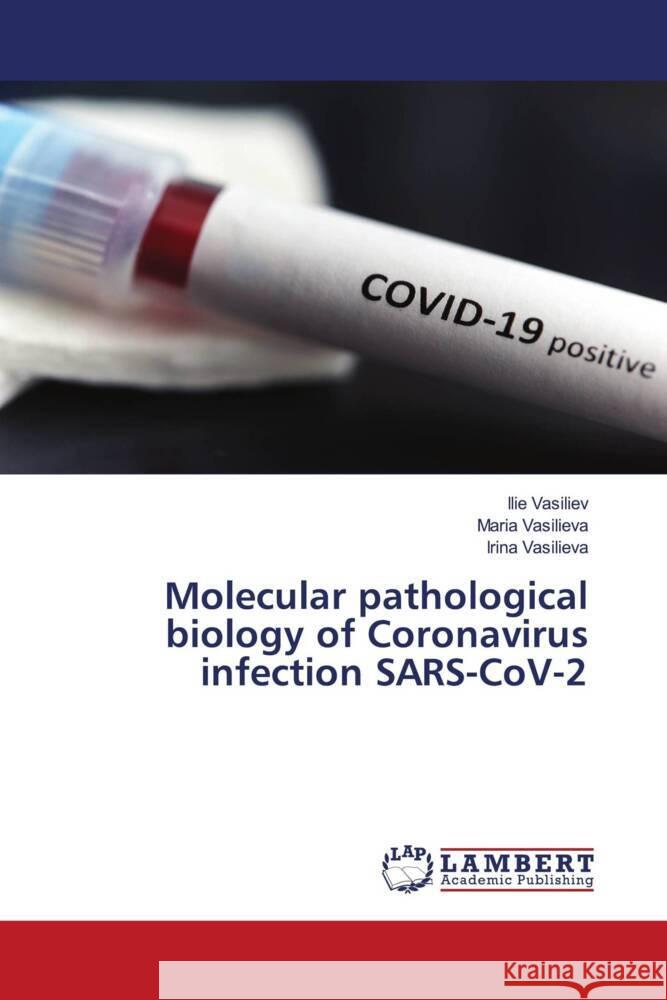 Molecular pathological biology of Coronavirus infection SARS-CoV-2 Vasiliev, Ilie, Vasilieva, Maria, Vasilieva, Irina 9786207448661 LAP Lambert Academic Publishing - książka