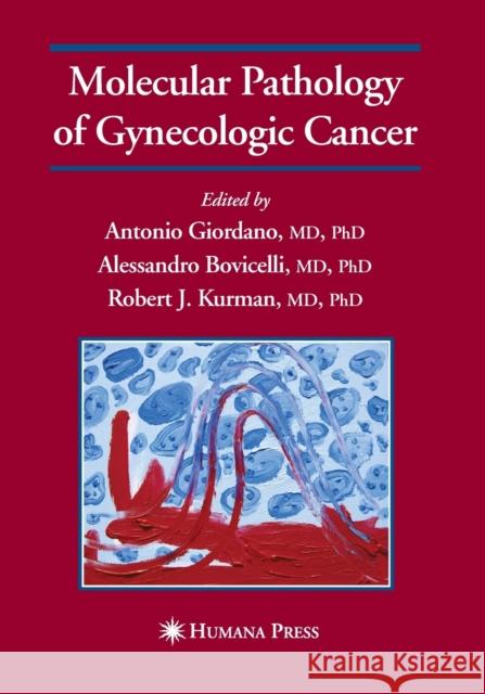 Molecular Pathology of Gynecologic Cancer Antonio Giordano Alessandro Bovicelli Robert J. Kurman 9781493956777 Humana Press - książka
