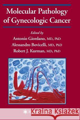 Molecular Pathology of Gynecologic Cancer Antonio Giordano Alessandro Bovicelli Robert J. Kurman 9781588294531 Humana Press - książka