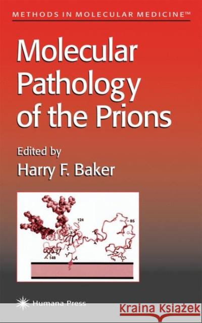Molecular Pathology of the Prions Harry F. Baker 9780896039247 Humana Press - książka
