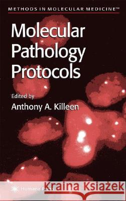 Molecular Pathology Protocols Anthony A. Killeen 9780896036819 Humana Press - książka