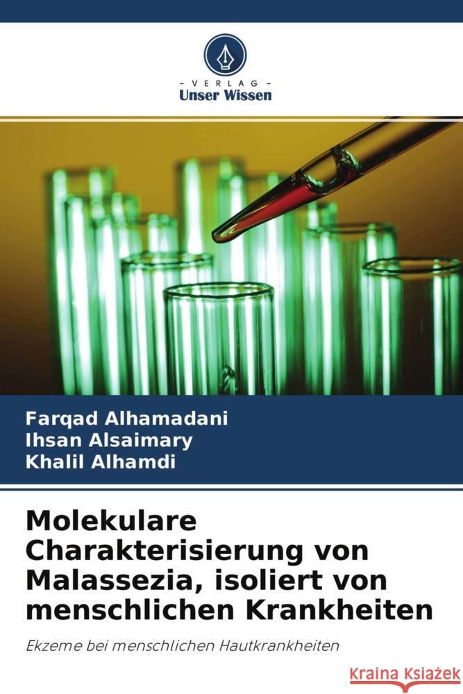 Molekulare Charakterisierung von Malassezia, isoliert von menschlichen Krankheiten Alhamadani, Farqad, Alsaimary, Ihsan Edan, Alhamdi, Khalil 9786204757490 Verlag Unser Wissen - książka