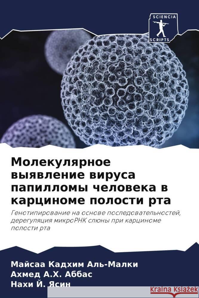 Molekulqrnoe wyqwlenie wirusa papillomy cheloweka w karcinome polosti rta Al'-Malki, Majsaa Kadhim, Abbas, Ahmed A.H., Yasin, Nahi J. 9786208298180 Sciencia Scripts - książka