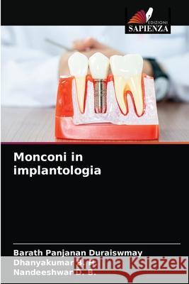 Monconi in implantologia Barath Panjanan Duraiswmay, Dhanyakumar B H, Nandeeshwar D B 9786203241433 Edizioni Sapienza - książka