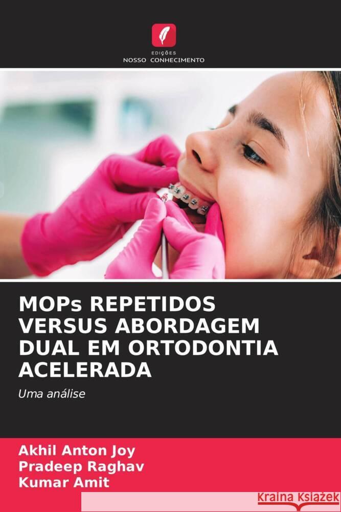 MOPs REPETIDOS VERSUS ABORDAGEM DUAL EM ORTODONTIA ACELERADA Joy, Akhil Anton, Raghav, Pradeep, Amit, Kumar 9786208249748 Edições Nosso Conhecimento - książka