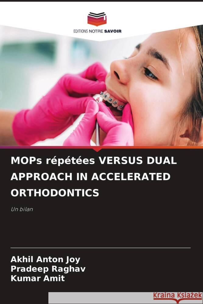 MOPs répétées VERSUS DUAL APPROACH IN ACCELERATED ORTHODONTICS Joy, Akhil Anton, Raghav, Pradeep, Amit, Kumar 9786208249762 Editions Notre Savoir - książka