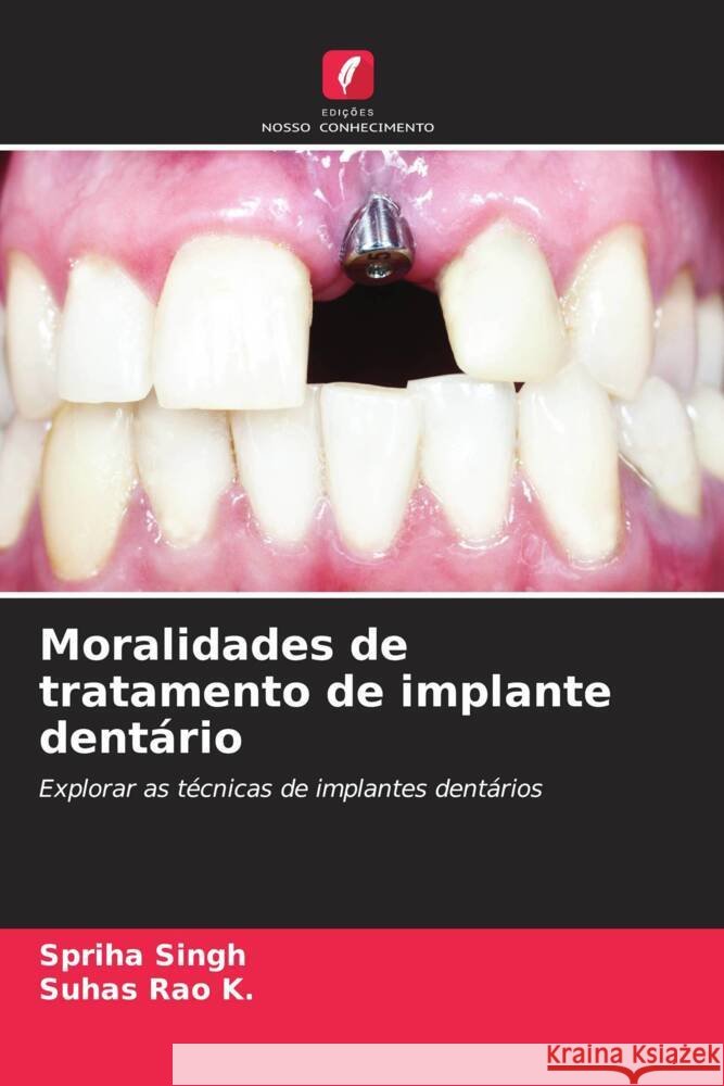 Moralidades de tratamento de implante dent?rio Spriha Singh Suhas Rao K 9786208069216 Edicoes Nosso Conhecimento - książka